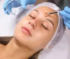 Imagen del Servicio Peeling cosmiátrico