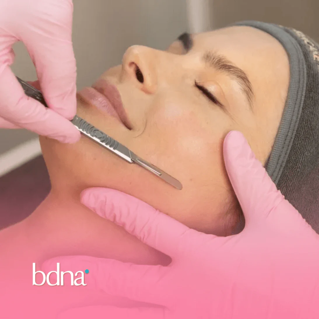 Imagen del Servicio Dermaplaning