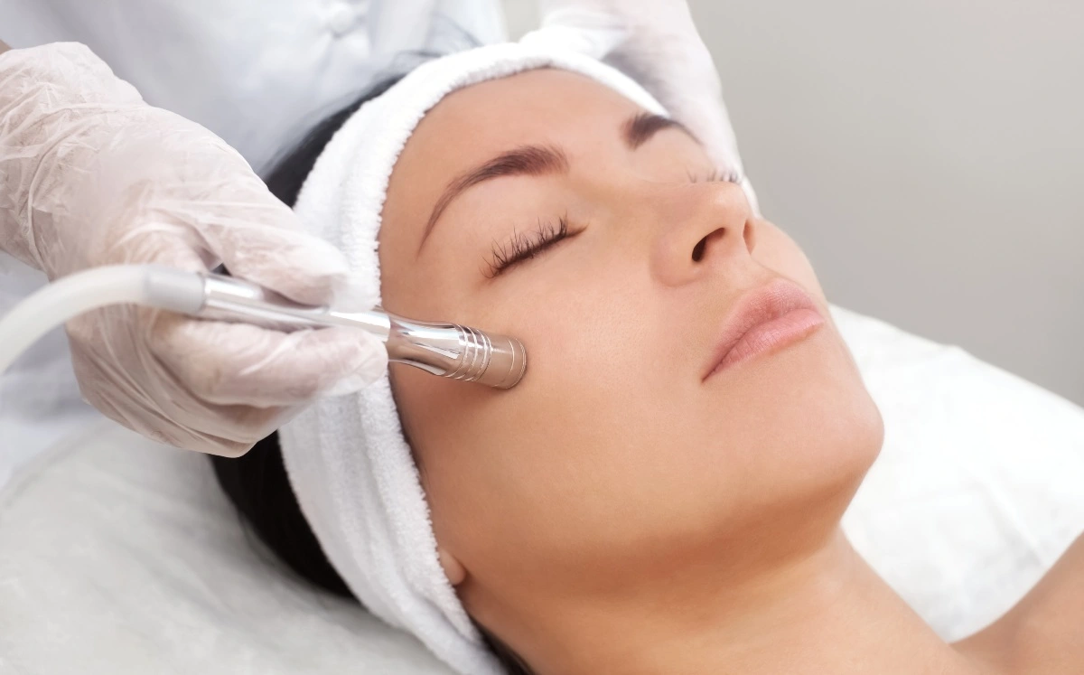 Imagen del Servicio Exosomas con microneedling